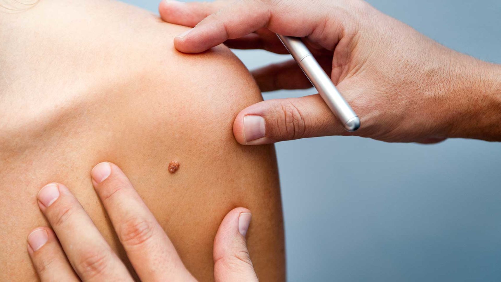 Die Behandlung von Hauterkrankungen im MVZ Hansaklinik in Dortmund