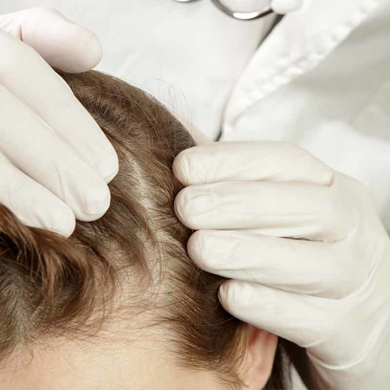 Schuppenflechte auf der Kopfhaut behandeln die Ärzte im MVZ Hansaklinik in Dortmund.