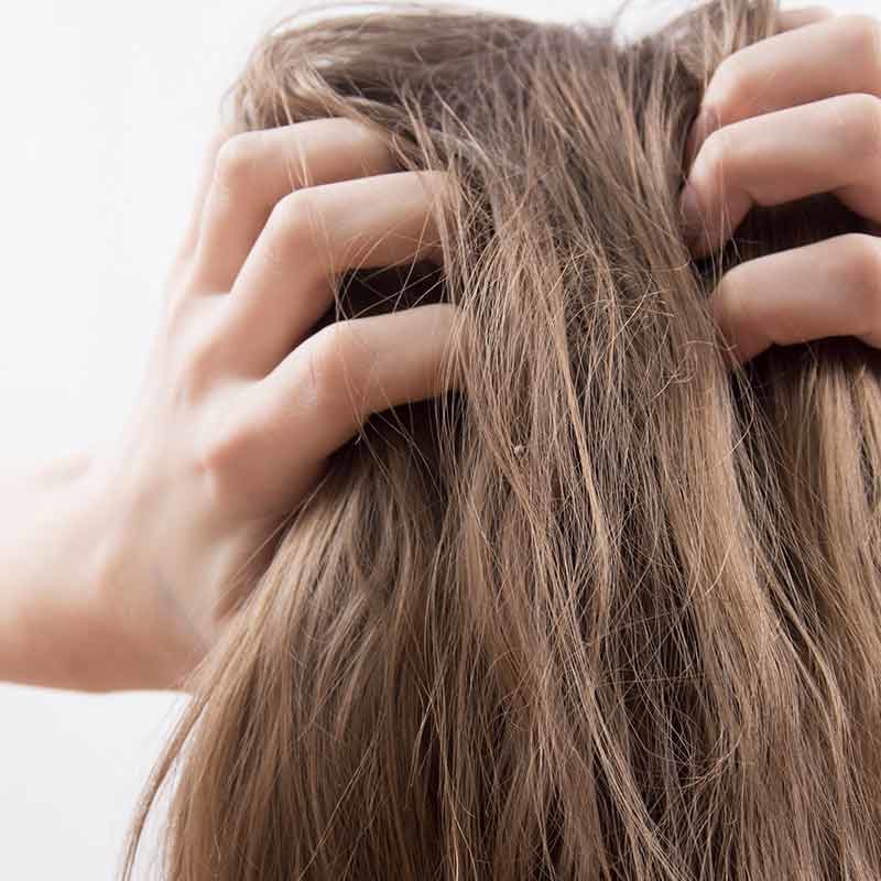 Das seborrhoische Ekzem ist eine Haarerkrankung, die im MVZ Hansaklinik in Dortmund behandelt wird.